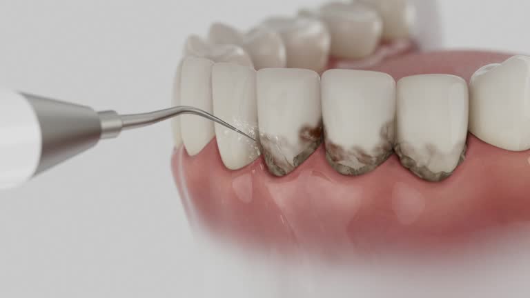 Reliable Teeth Cleaning And Checkup contractor in Chickasaw County County, MS by Dentist Open Now